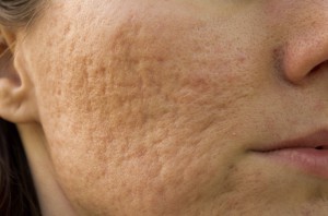 iStock_000026728473Large