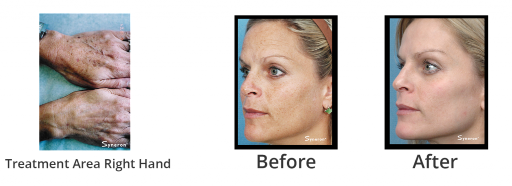 facial2_01