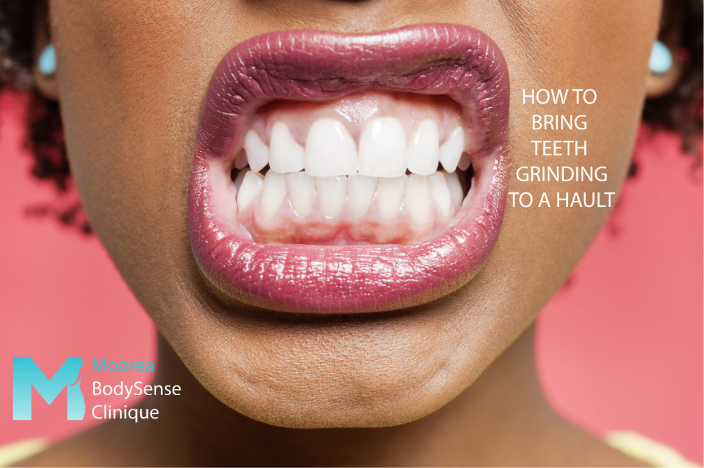 Do you suffer from chronic teeth grinding? Moorea Body Clinique can help you! 